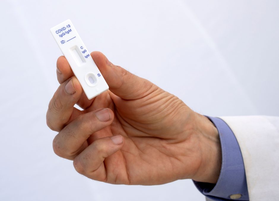 Mokslininkai: greitieji testai koronaviruso diagnostikai netinka