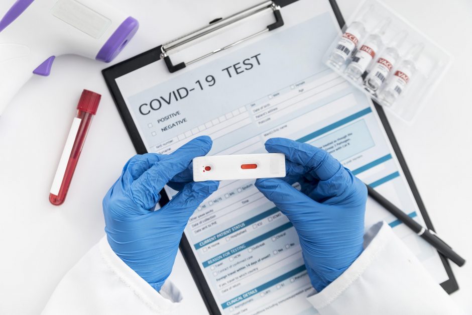 ES priartėjo prie COVID-19 antigenų testų pripažinimo bloko mastu