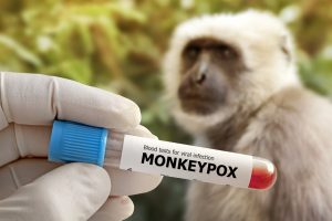 PSO: pasaulyje registruota per 50 tūkst. beždžionių raupų atvejų