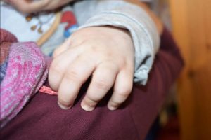 Vilniaus medikų rankose dėl sužalojimų atsidūrė 2022 metais gimęs mažylis