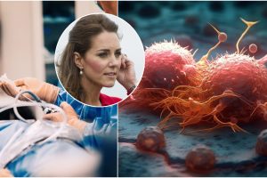 Velso princesei Kate taikoma prevencinė chemoterapija: paaiškino, kas tai  