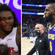 „Lakers“ vizitas Detroite: išvarytas varžovo kraują praliejęs LeBronas ir 15 minučių konfliktas