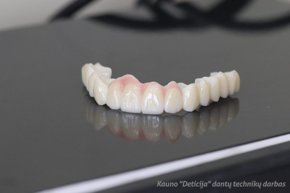 Dantų protezavimas: cirkonis ar metalas – ką pasirinkti?