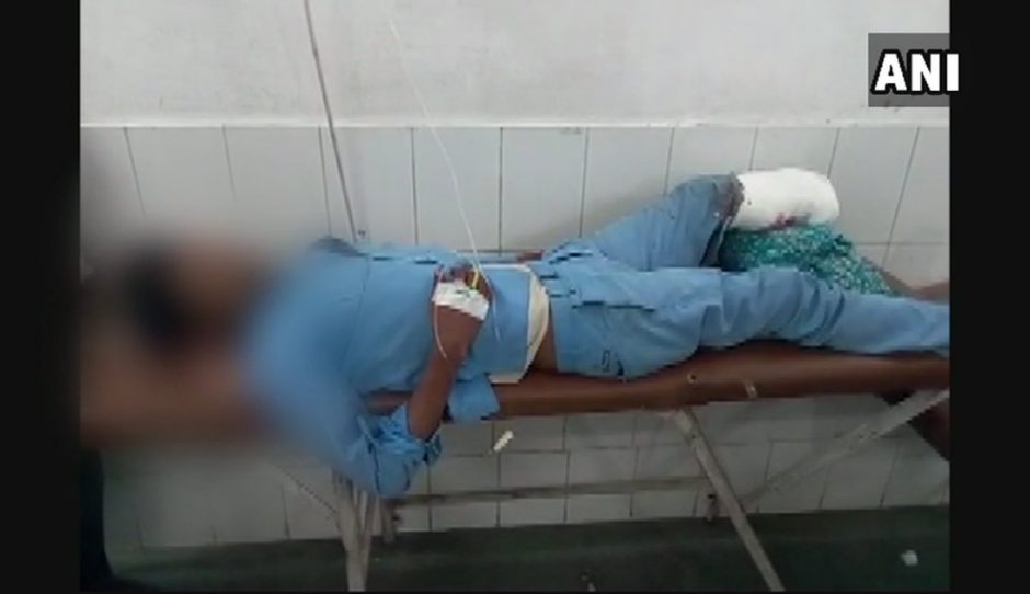 Indijos ligoninėje vietoj pagalvės panaudota nuplėšta paciento koja