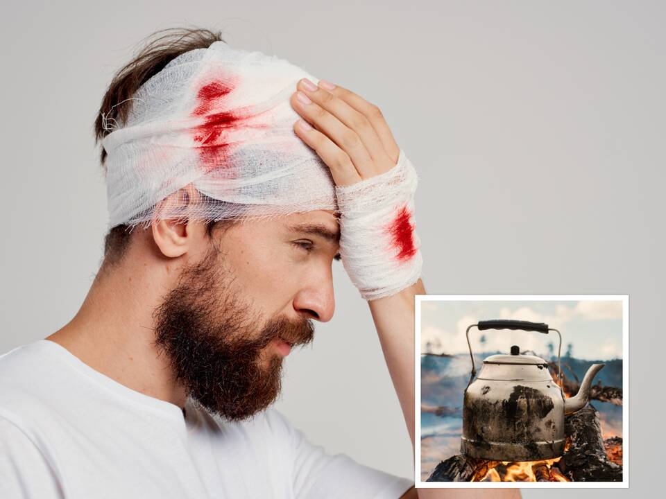 Barnis baigėsi tragiškai: vyro veidą suknežino virduliu