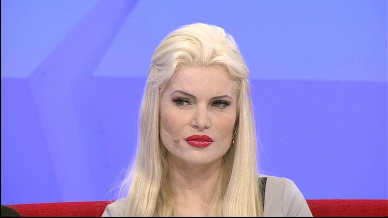 5 plastinės operacijos ir 20 kartų putlintos lūpos – dar ne pabaiga