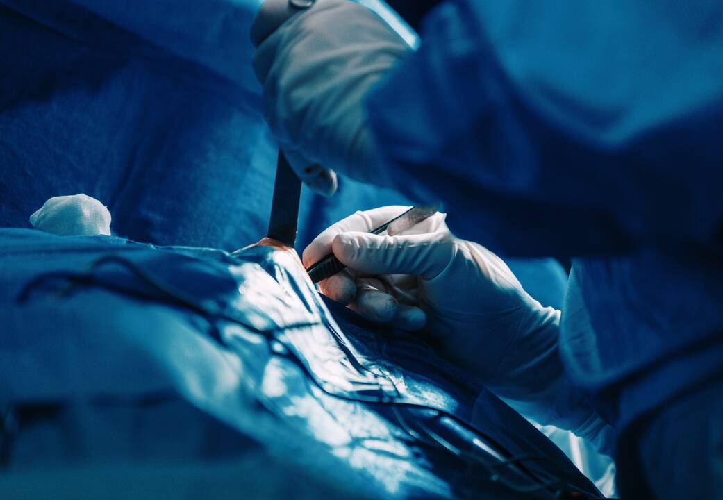 Pasirinkimas: krūties rekonstrukcijos būdų yra ne vienas – galima krūtį ar prarastą jos dalį atkurti savaisiais audiniais arba panaudojant individualiai parinktą implantą.