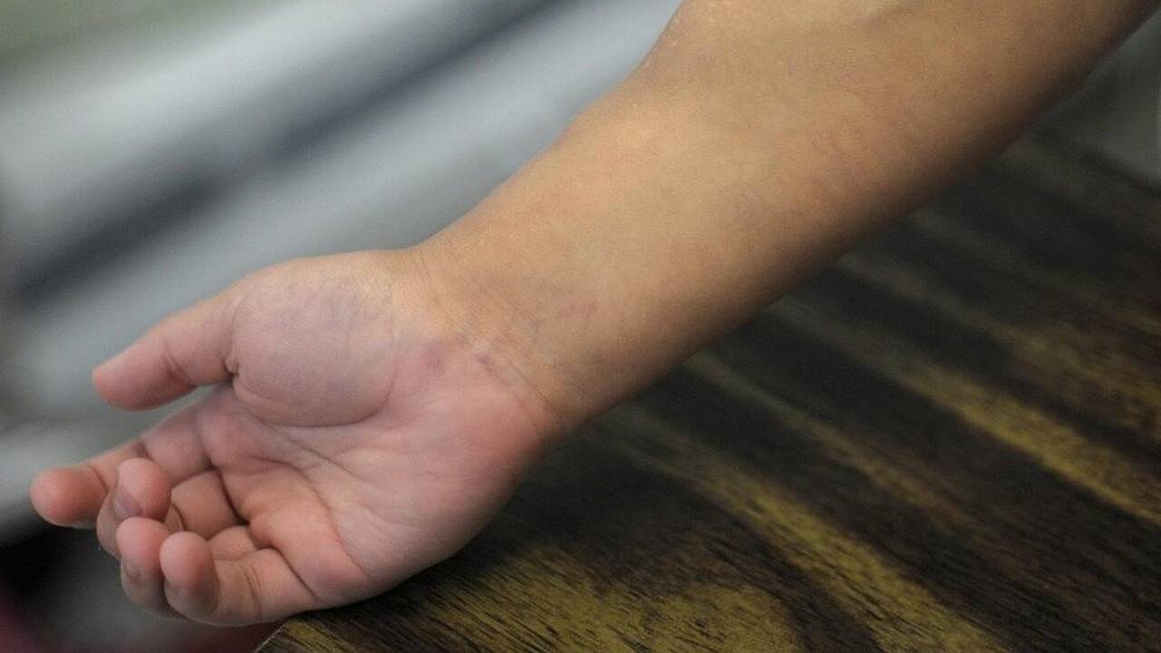 Lietuviai imasi vieno ambicingiausių projektų Europoje: augins žmogaus venas