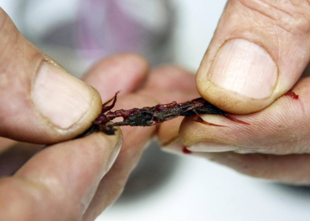 Radinys: klaipėdietis lenkiškų marinuotų burokėlių stiklainyje aptiko keistų priedų, primenančių kažkokio mažo graužiko griaučių liekanas.