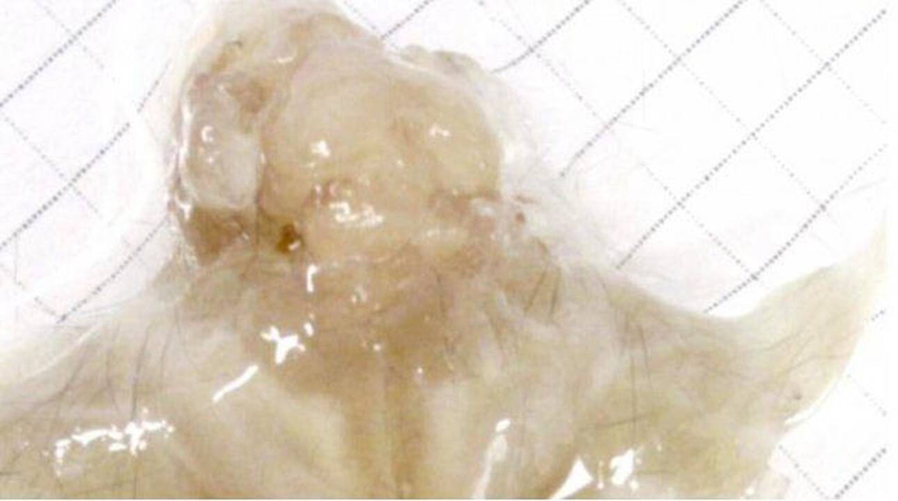 Sukurtas visiškai permatomas kūnas padės perprasti vėžį