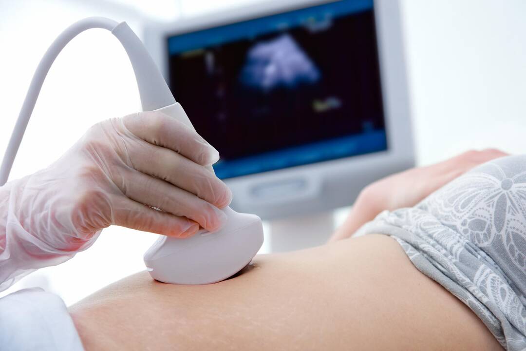 Gydytoja: pagalbinio apvaisinimo įstatymą priimti trukdo politikai ir bažnyčia