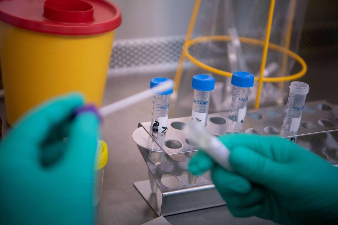 Teismas leido tęsti COVID-19 testų sistemų pirkimo konkursą