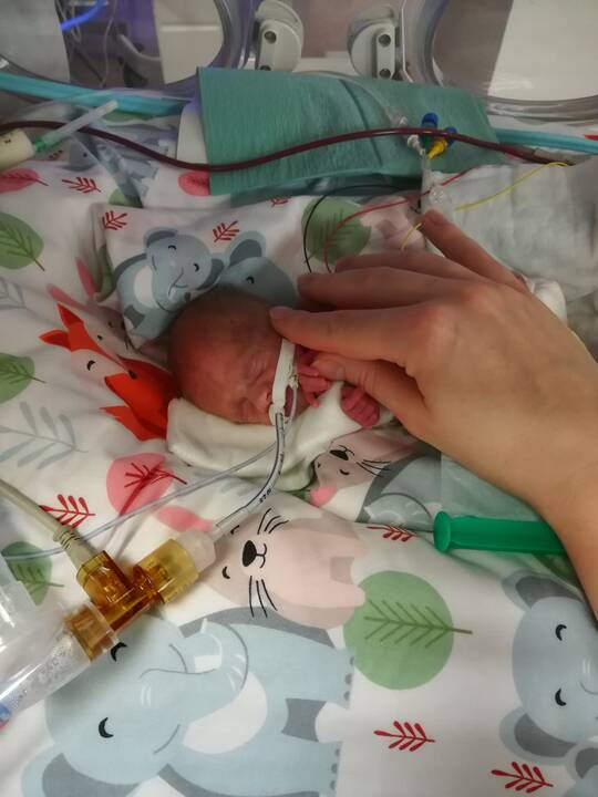 Jausmai: išgelbėtą vos 514 g svėrusios dukros gyvybę tėvai vadina stebuklu.