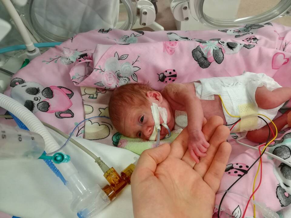 Jausmai: išgelbėtą vos 514 g svėrusios dukros gyvybę tėvai vadina stebuklu.