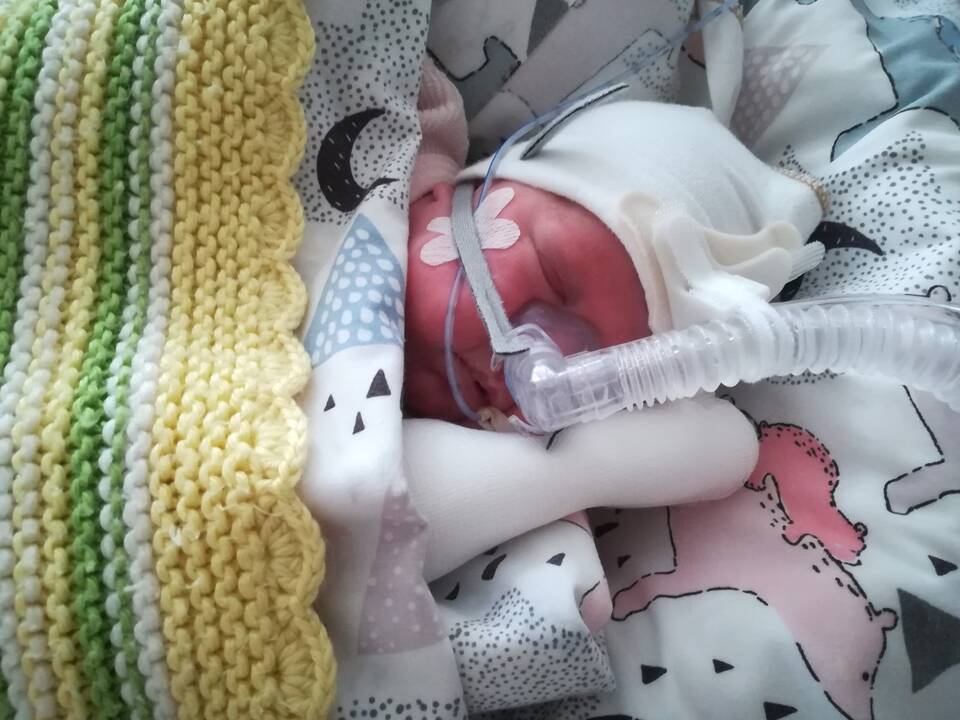Jausmai: išgelbėtą vos 514 g svėrusios dukros gyvybę tėvai vadina stebuklu.