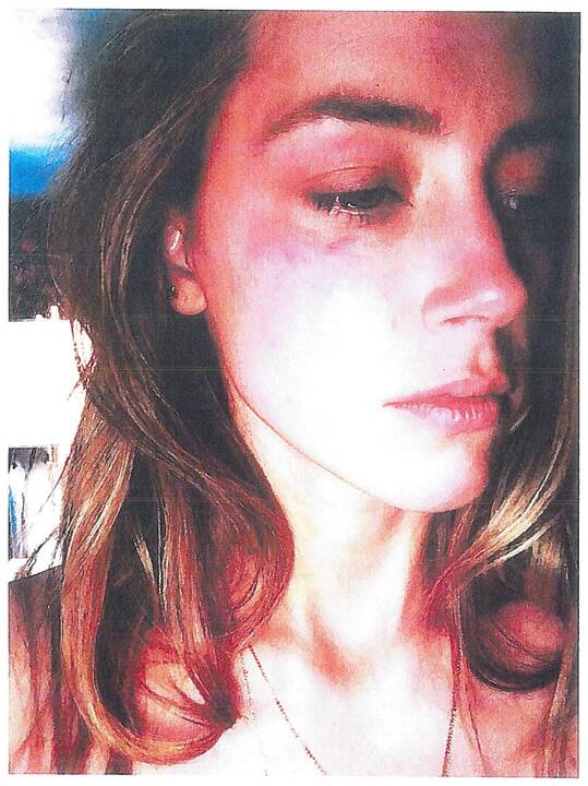 Amber Heard ir Johnny Deppas