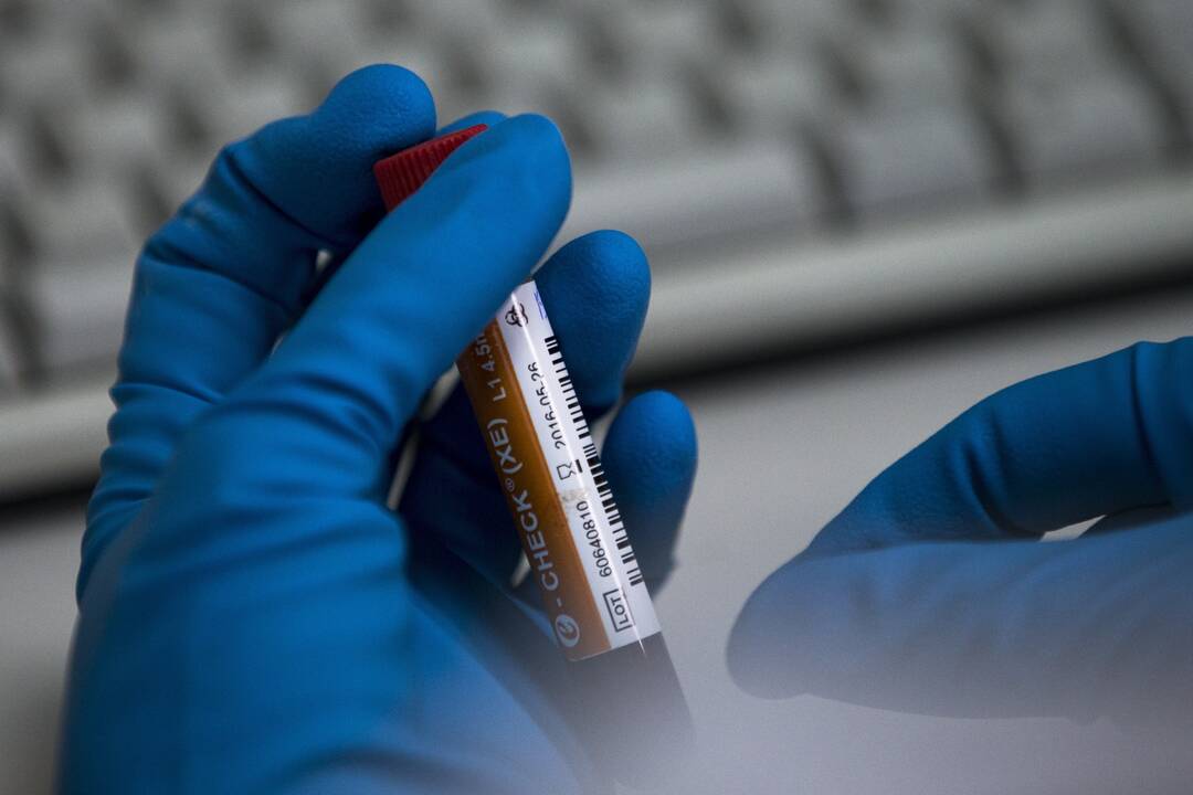 WADA: COVID-19 pandemija galėjo pakenkti kovai už „švarų sportą“