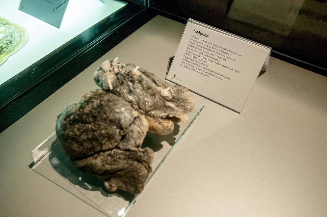 "Body worlds vital" paroda Kaune