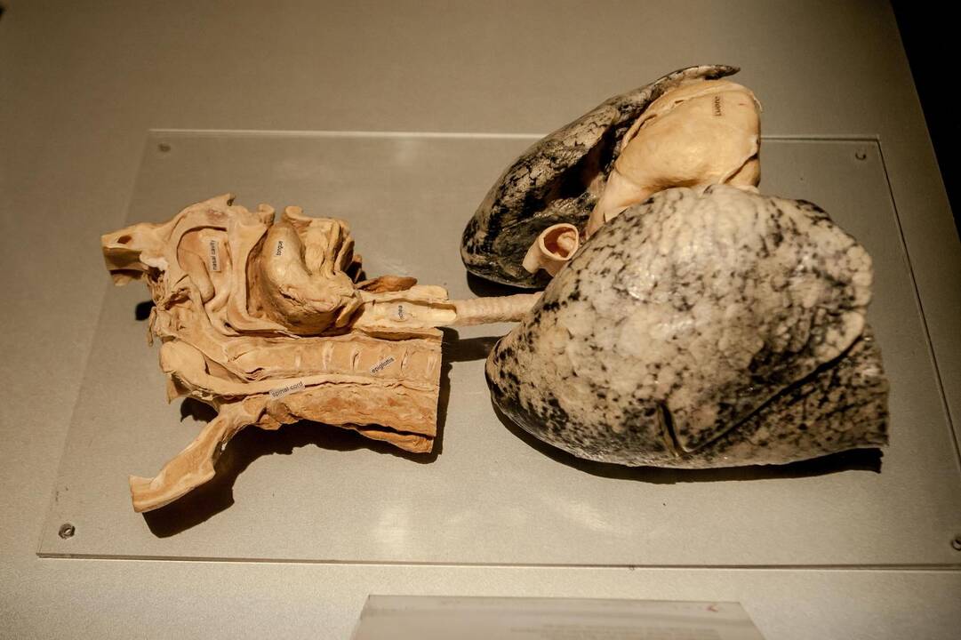 "Body worlds vital" paroda Kaune