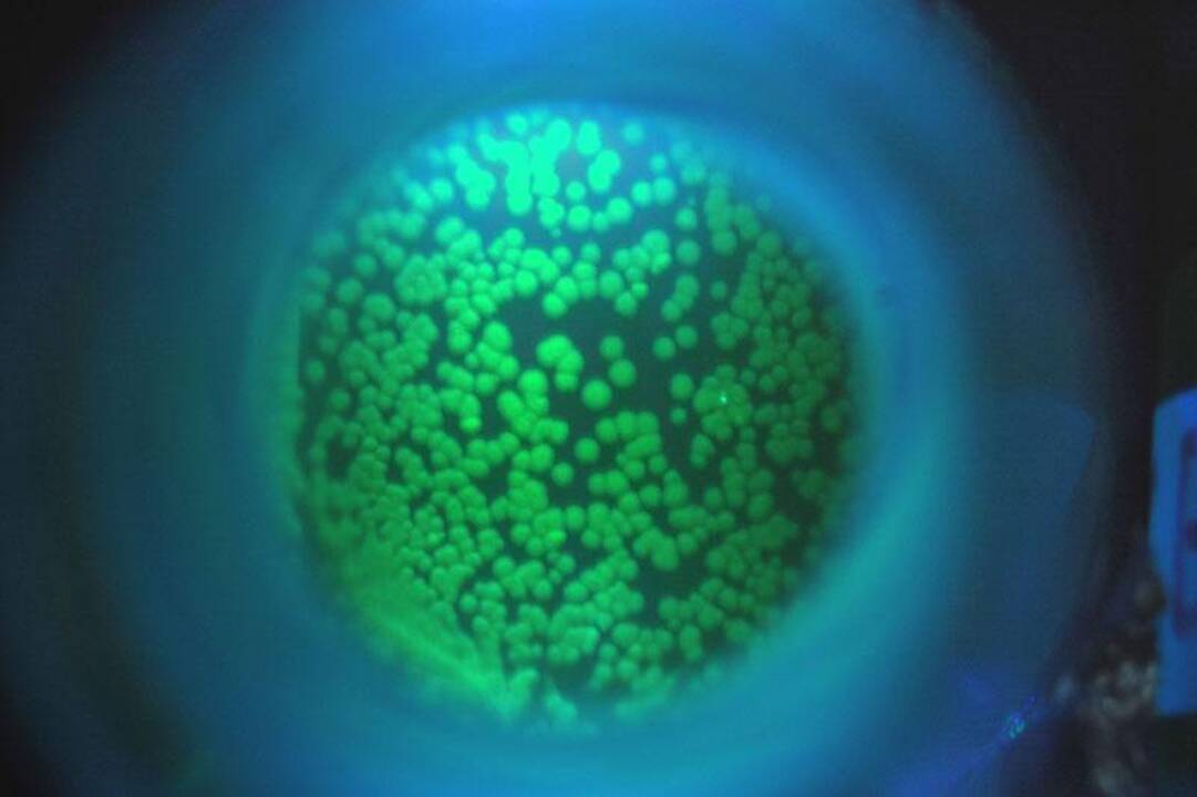 „Gyvi kompiuteriai“ taps realybe: sukurtos dalys iš bakterijų ir DNR