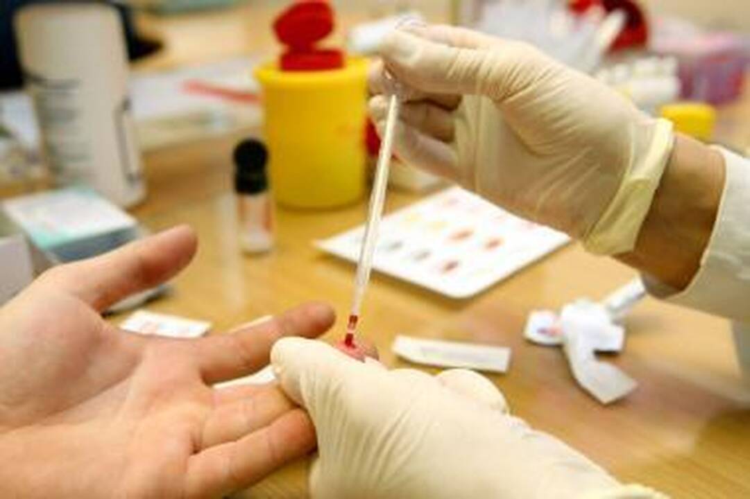Iš kraujo mėginio galima nustatyti žmogaus amžių
