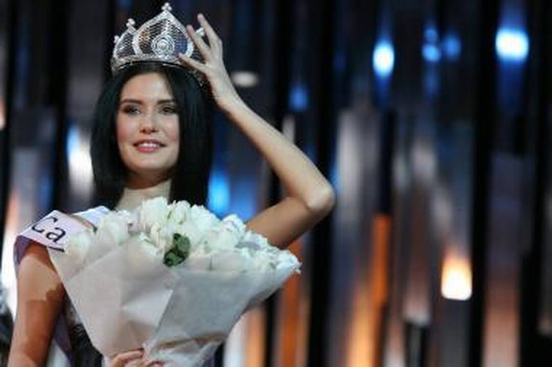 Gražuolės karjerą žlugdo erotinės nuotraukos