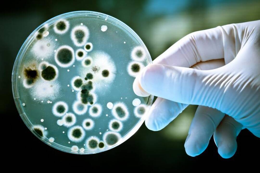 A.Kubilius: dėl infekcijų protrūkio sanitarijos tarnybos dirba atidžiau