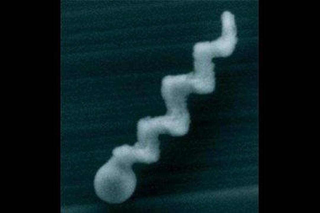 Vaistus žmogaus kūne gabens nanorobotai