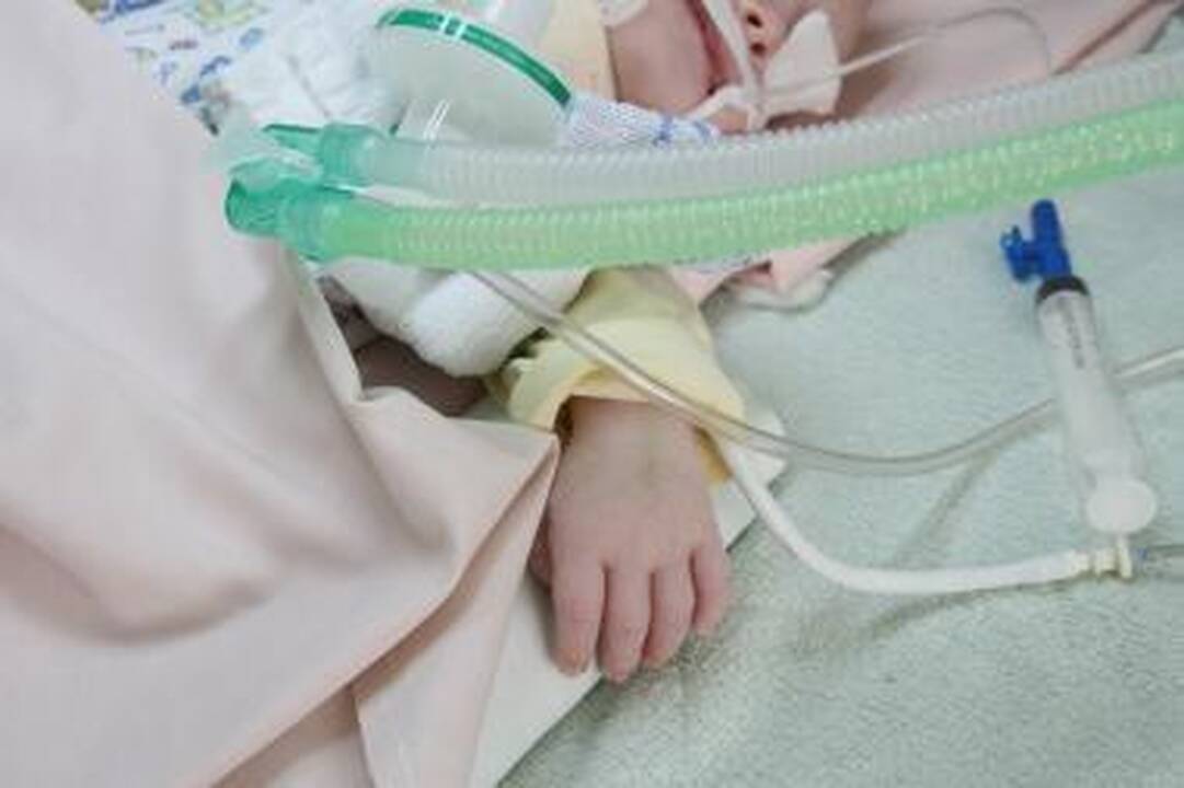 Kaune sunkiai sužalotas metukų neturintis kūdikis