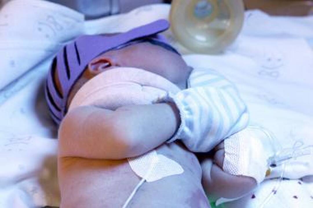 Į ligoninę pateko kūdikis su sulaužyta kaukole 