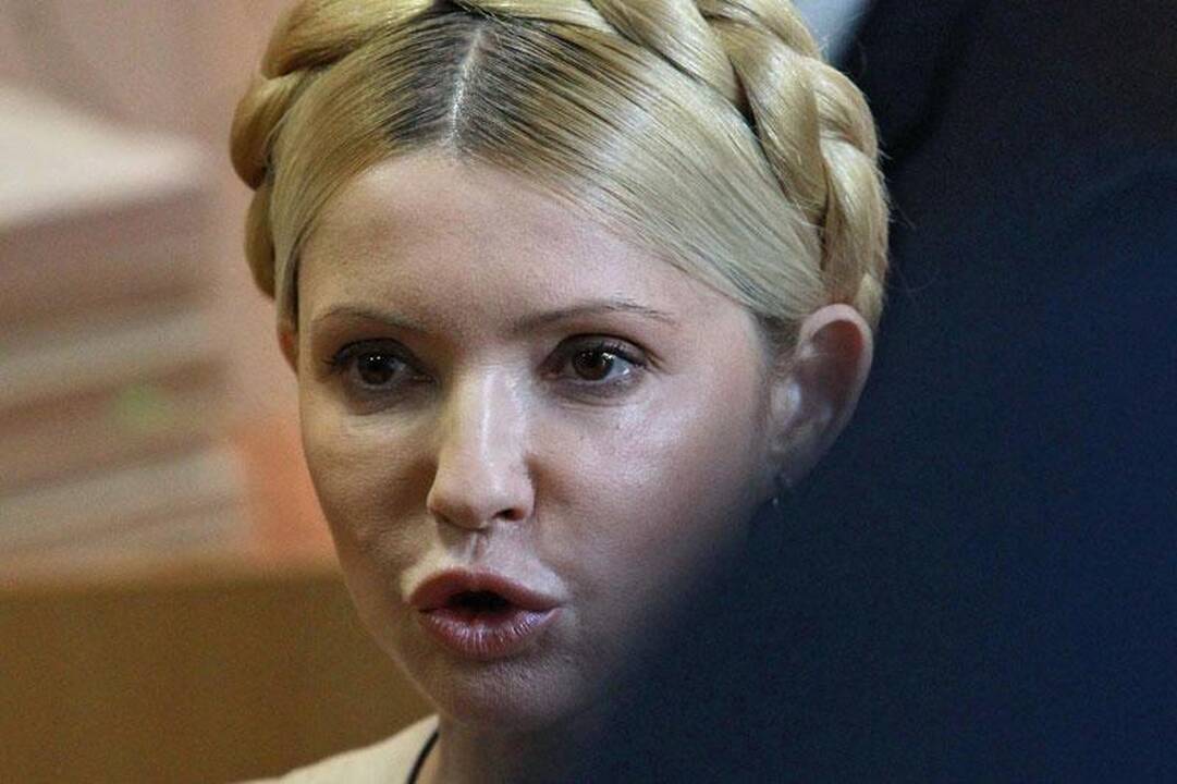 J.Tymošenko sąlygos kolonijoje atitinka Europos normas?
