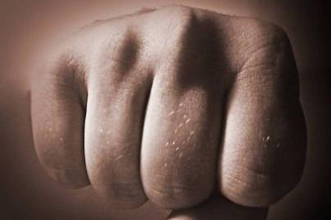 Kaunietė smogė uniformuotam policijos pareigūnui