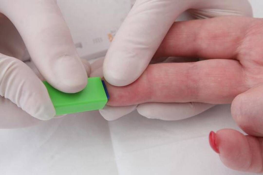 Klaipėdiečiai nemokamai tikrinami dėl hepatito