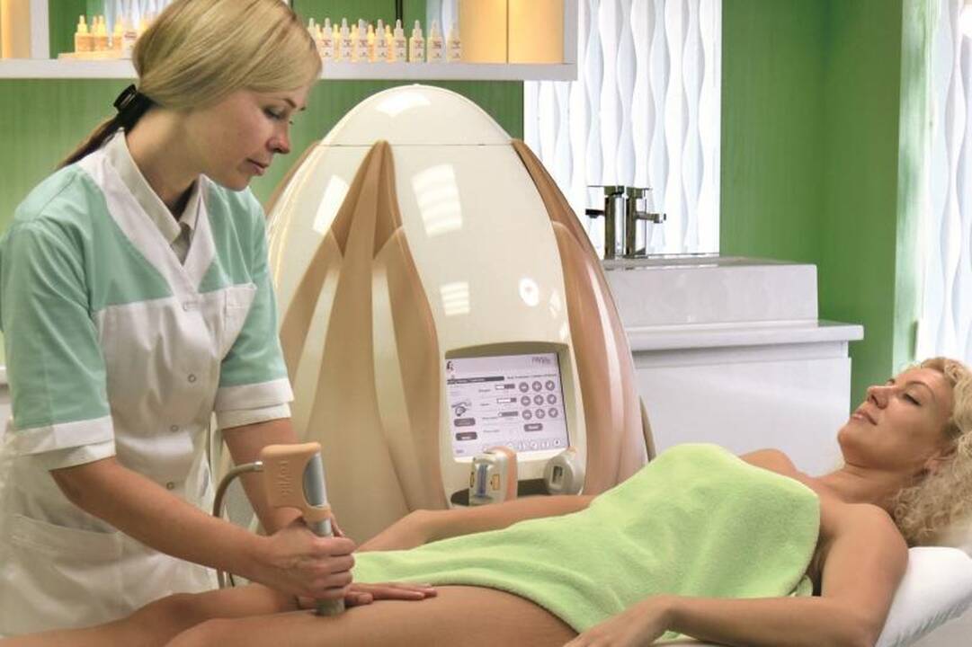Celiulito išvargintą odą gražina akustinių bangų terapija