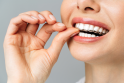 Laikas: beveik nematomas dantų tiesinimo kapas reikia nešioti ne mažiau kaip 22 valandas per parą, tačiau prieš valgant reikia išsiimti.
