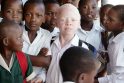 Šamanų „aukojimo ceremonijai“ pagrobtas albinosas