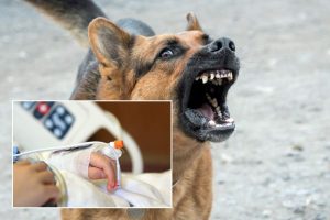 Skaudi nelaimė: voljere šuo apkandžiojo trijų metų vaiką