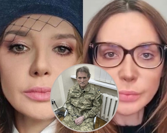 Chirurgai įvertino V. Medvedčuko žmonos veidą: kas taip nesėkmingai atliko plastinę operaciją?