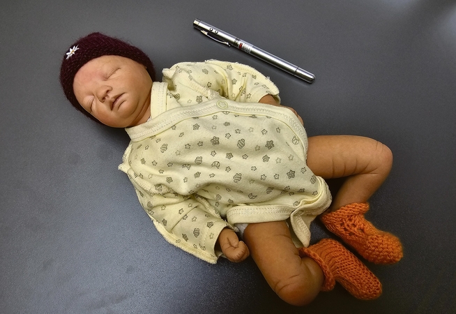 Palyginimas: kad būtų lengviau įsivaizduoti 1 249 g svėrusio paciento dydį, gydytojai šalia maždaug tokio dydžio neišnešioto naujagimio manekeno padėjo tušinuką.