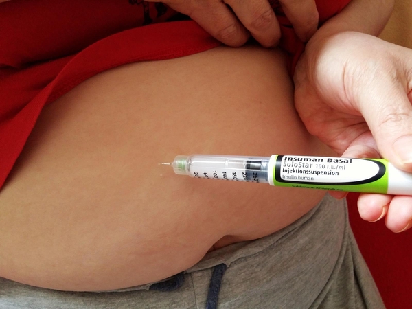 Diabetu serganti mergina: per parą būdavo net 15 dūrių 