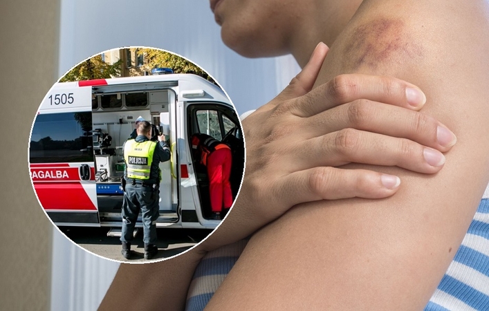Palangoje, benamių irštvoje, sumušta moteris: kol kas klausimų daugiau nei atsakymų