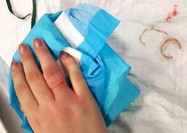 Medikai dalijasi pamokančia istorija: nesukarpykite meilės į šipulius