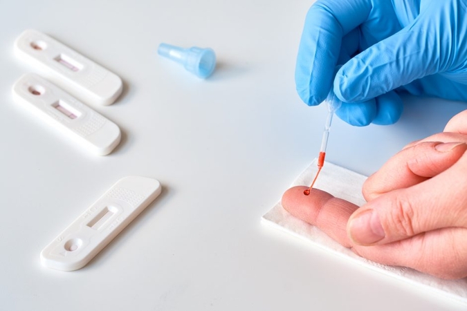 Laboratorijos vadovas: lėtas greitųjų koronaviruso testų naudojimas kelia nerimą