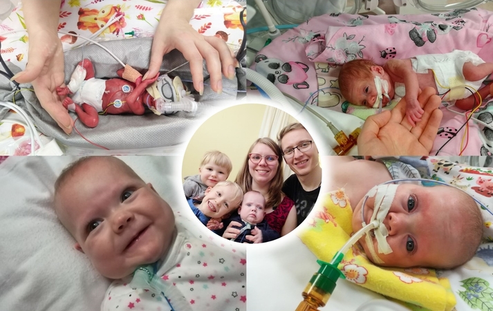 Jausmai: išgelbėtą vos 514 g svėrusios dukros gyvybę tėvai vadina stebuklu.