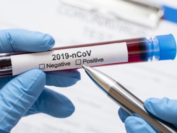 Epidemiologė: sergančiųjų koronavirusu skaičiaus augimas lėtėja