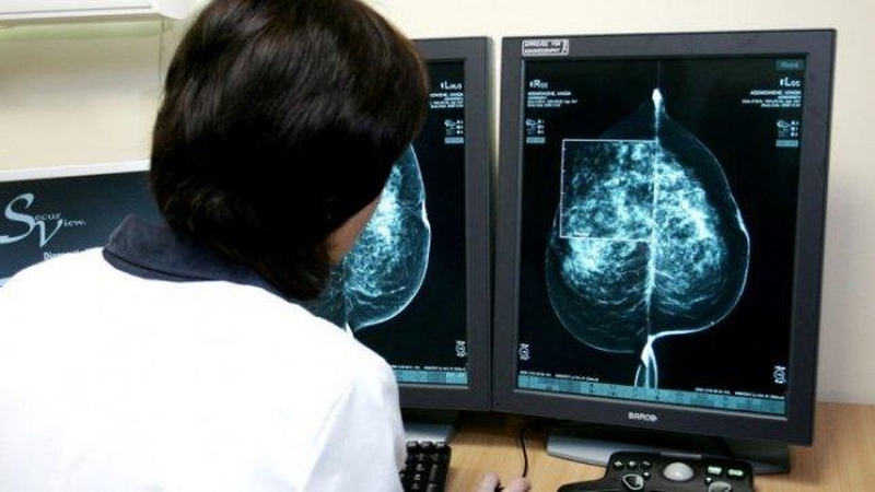 Kauno klinikų onkologai konsultuos rajonų gydymo įstaigose