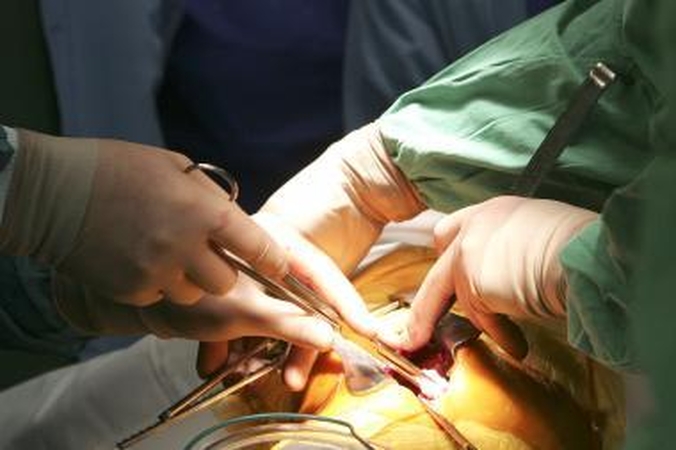Piktnaudžiavimas antibiotikais kelia grėsmę 