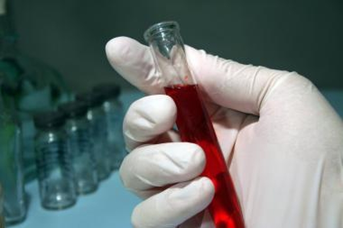 Sergantieji hemofilija prašo šiuolaikiško gydymo