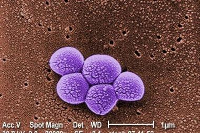 Varis įveikė antibiotikams atsparų auksinį stafilokoką