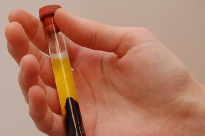 Profilaktiniai skydliaukės ir prostatos tyrimai - pigesni